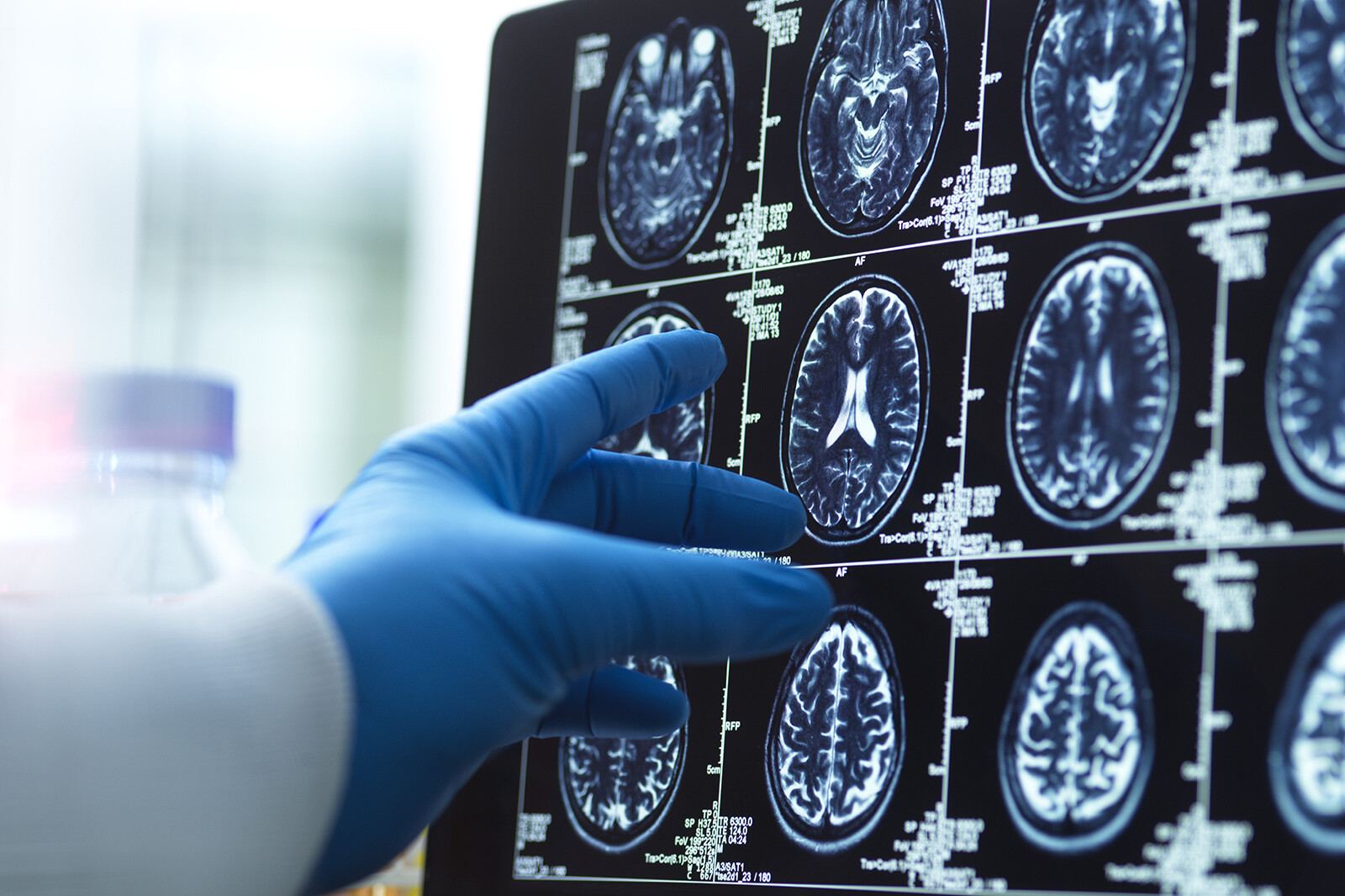 Dr. Rusk’s Precision Pillars of Brain Health Program