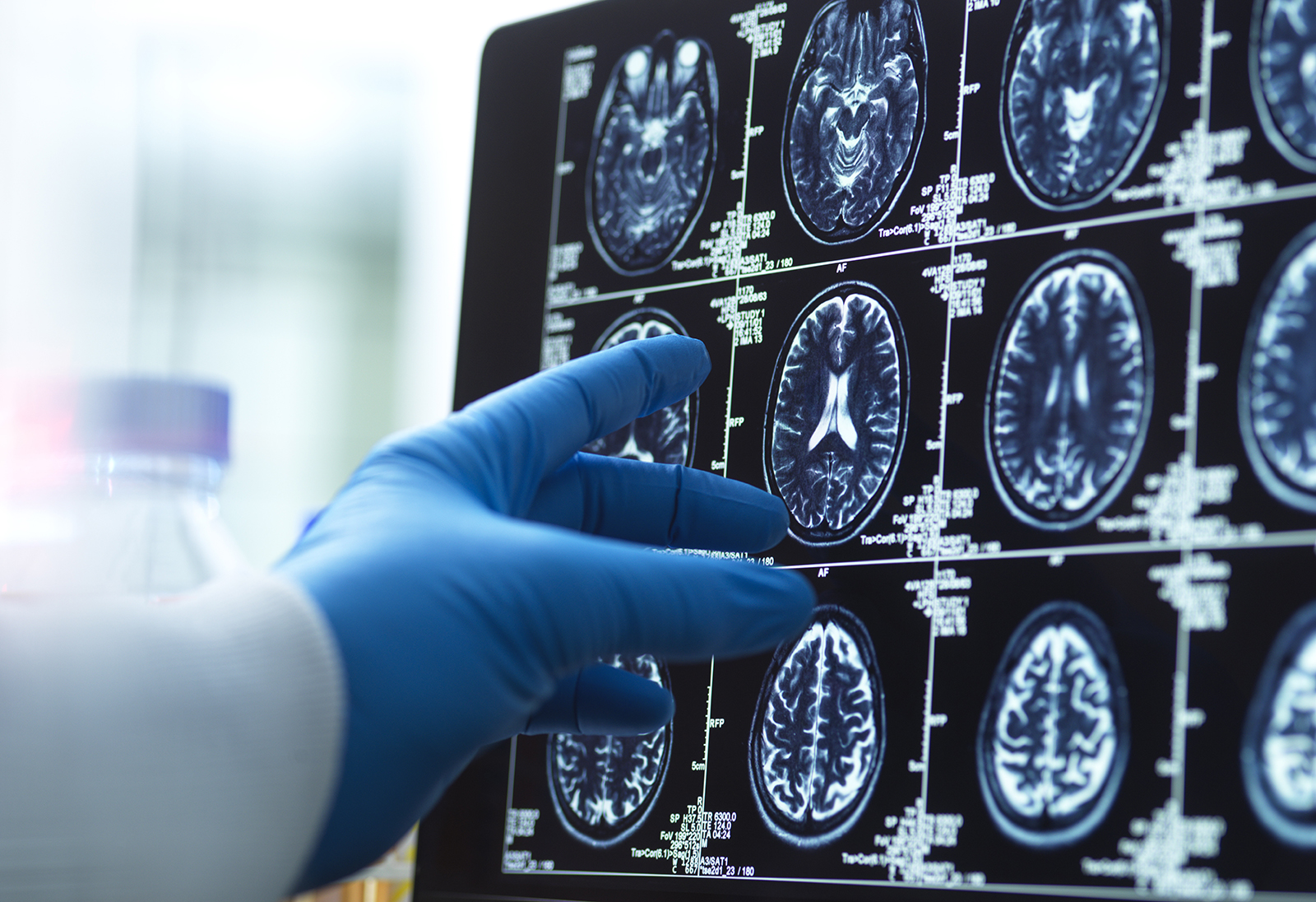 Dr. Rusk’s Precision Pillars of Brain Health Program